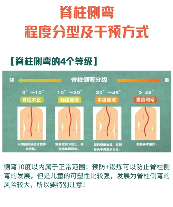 脊柱側彎程度分型