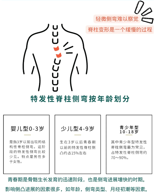 特發性脊柱側彎按年領劃分