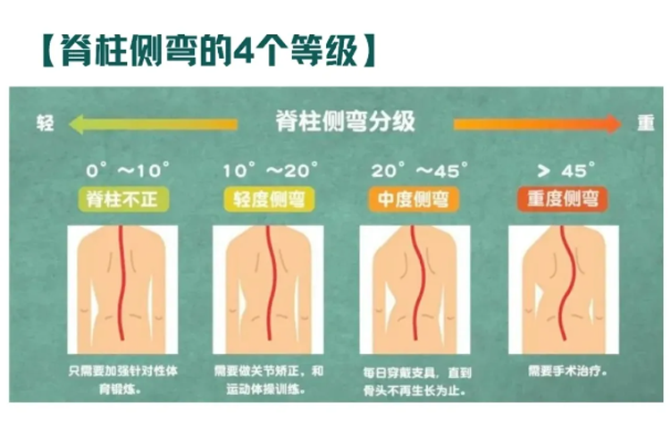 【坐姿一定要糾正‼️】孩子坐姿是關鍵，别再耽誤孩子